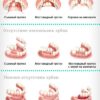 zubnye-protezy-semnye-i-nesemnye-konstrukcii-2